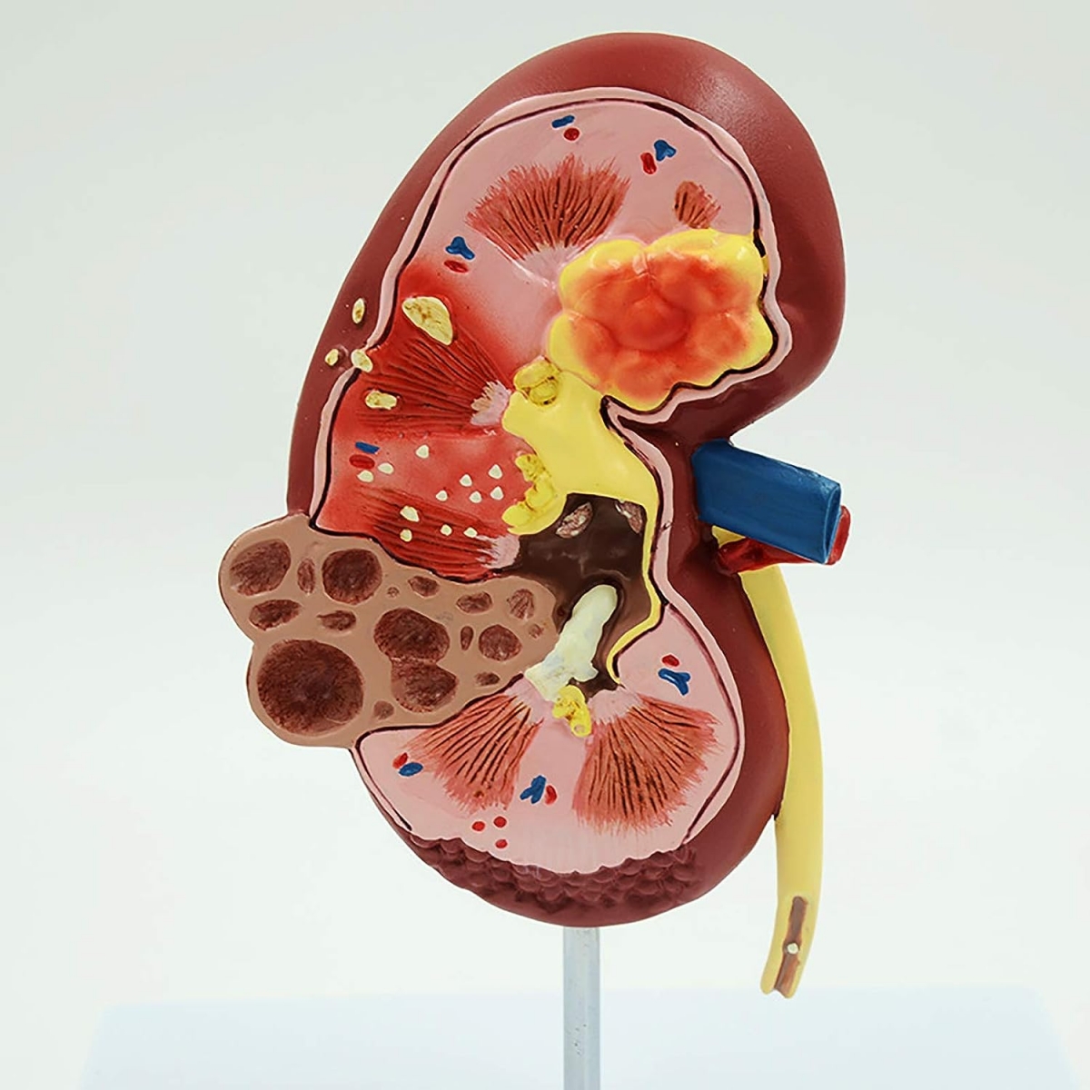 Human Kidney Model